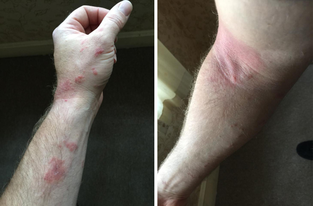 My buddy got a bad case of poison oak rash when he picked through some weeds at the gun range while looking for spent cartridges. This happened in early October, when most folks think that poisonous plants are not longer a problem. He won't think like that anymore!